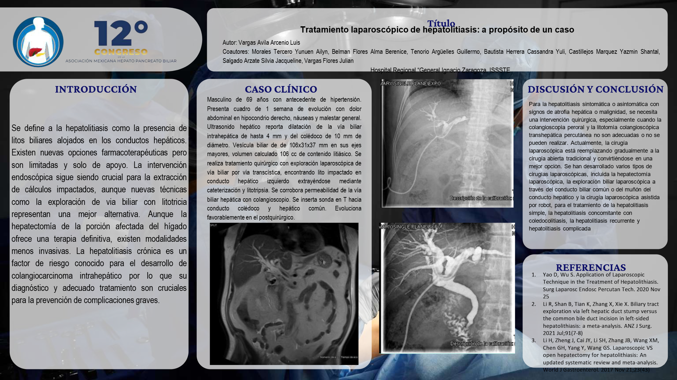 Póster de Tratamiento laparoscópico de hepatolitiasis: A propósito de un caso.