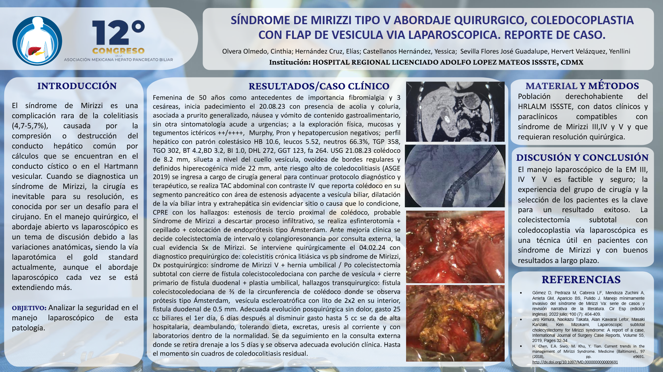 Póster de Síndrome de Mirizzi tipo v abordaje quirúrgico, coledocoplastia con Flap de vesícula vía laparoscópica. Reporte de caso.