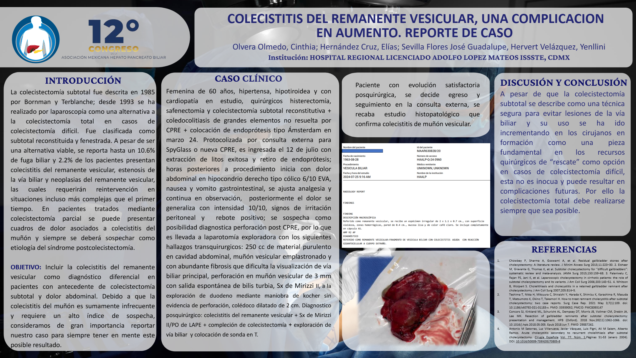 Póster de Colecistitis del remanente vesicular, una complicación en aumento. Reporte de caso.