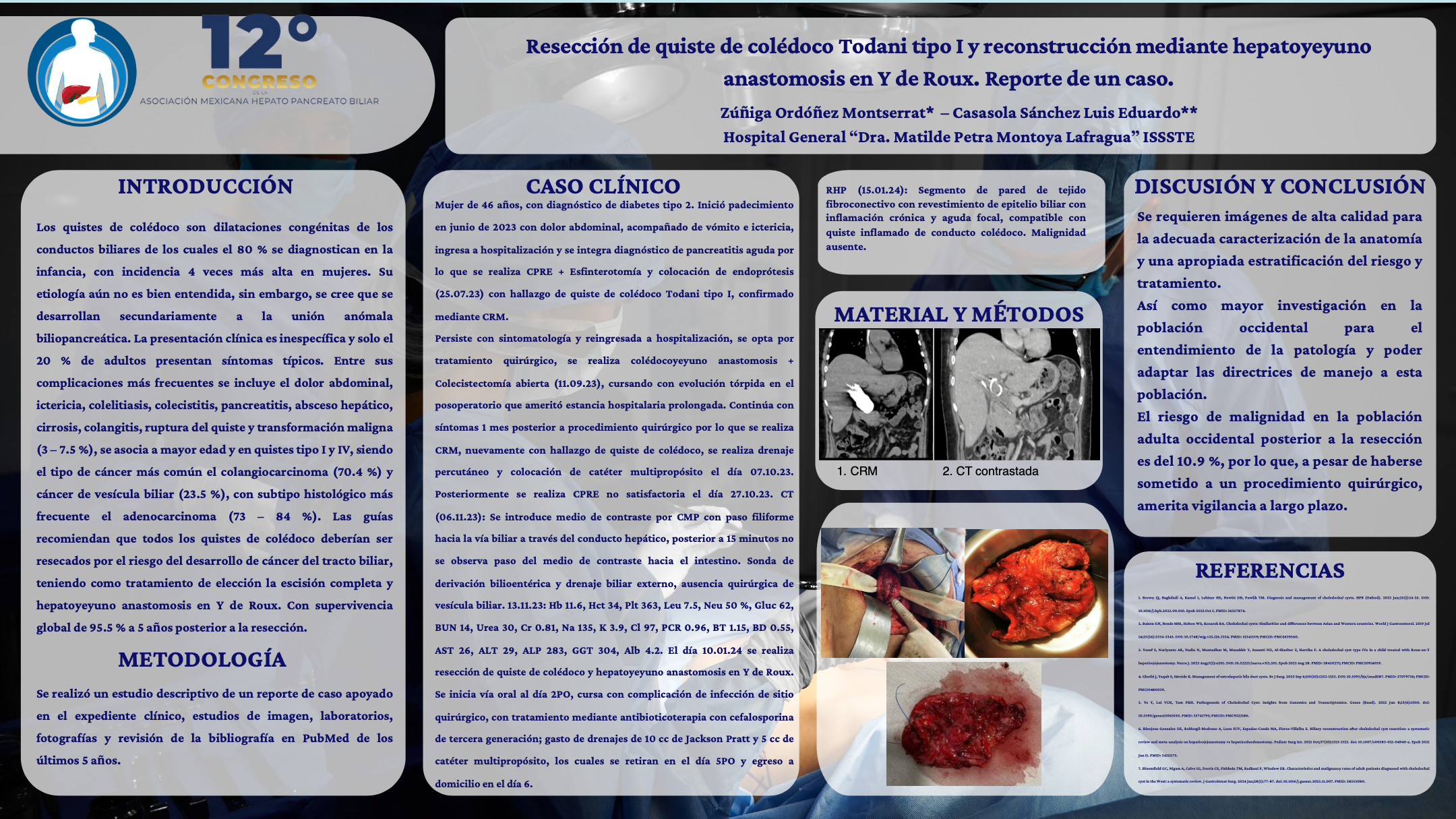 Póster de Resección de quiste de colédoco Todani tipo I y reconstrucción mediante hepatoyeyuno anastomosis en Y de Roux. Reporte de un caso.