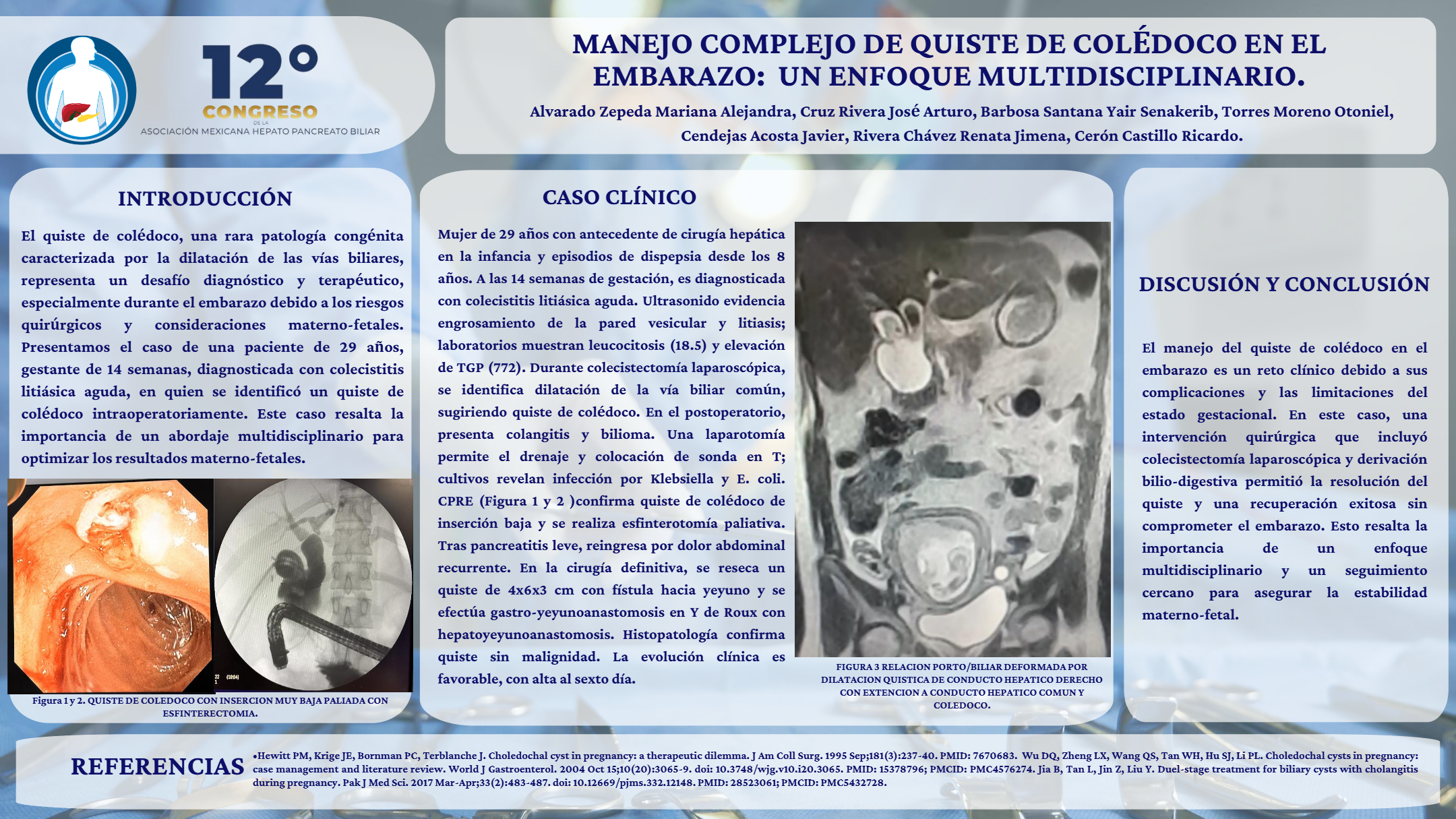 Póster de Manejo complejo de quiste de colédoco en el embarazo: un enfoque multidisciplinario. Case Report.