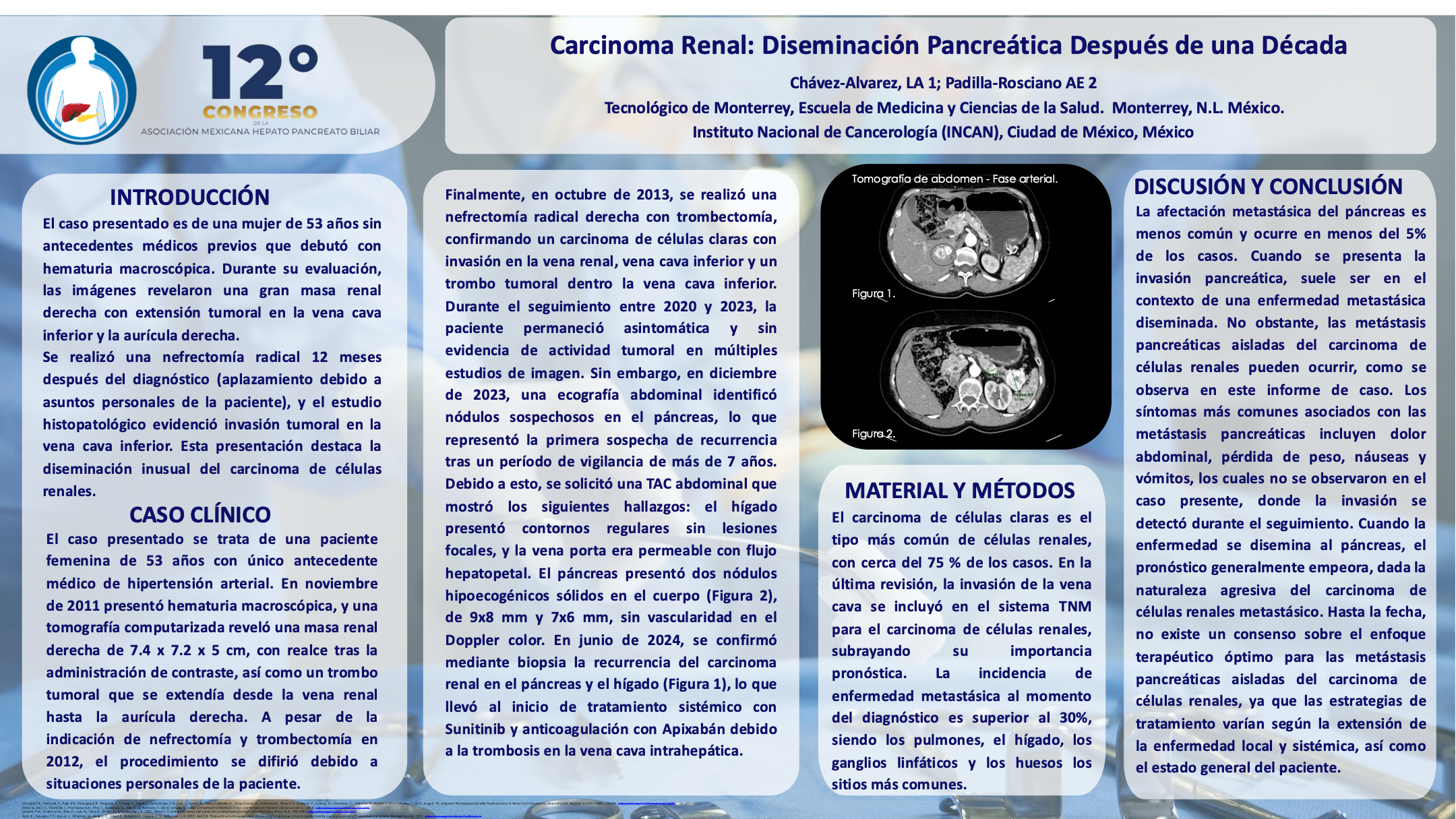 Póster de Carcinoma renal: diseminación pancreática después de una década.