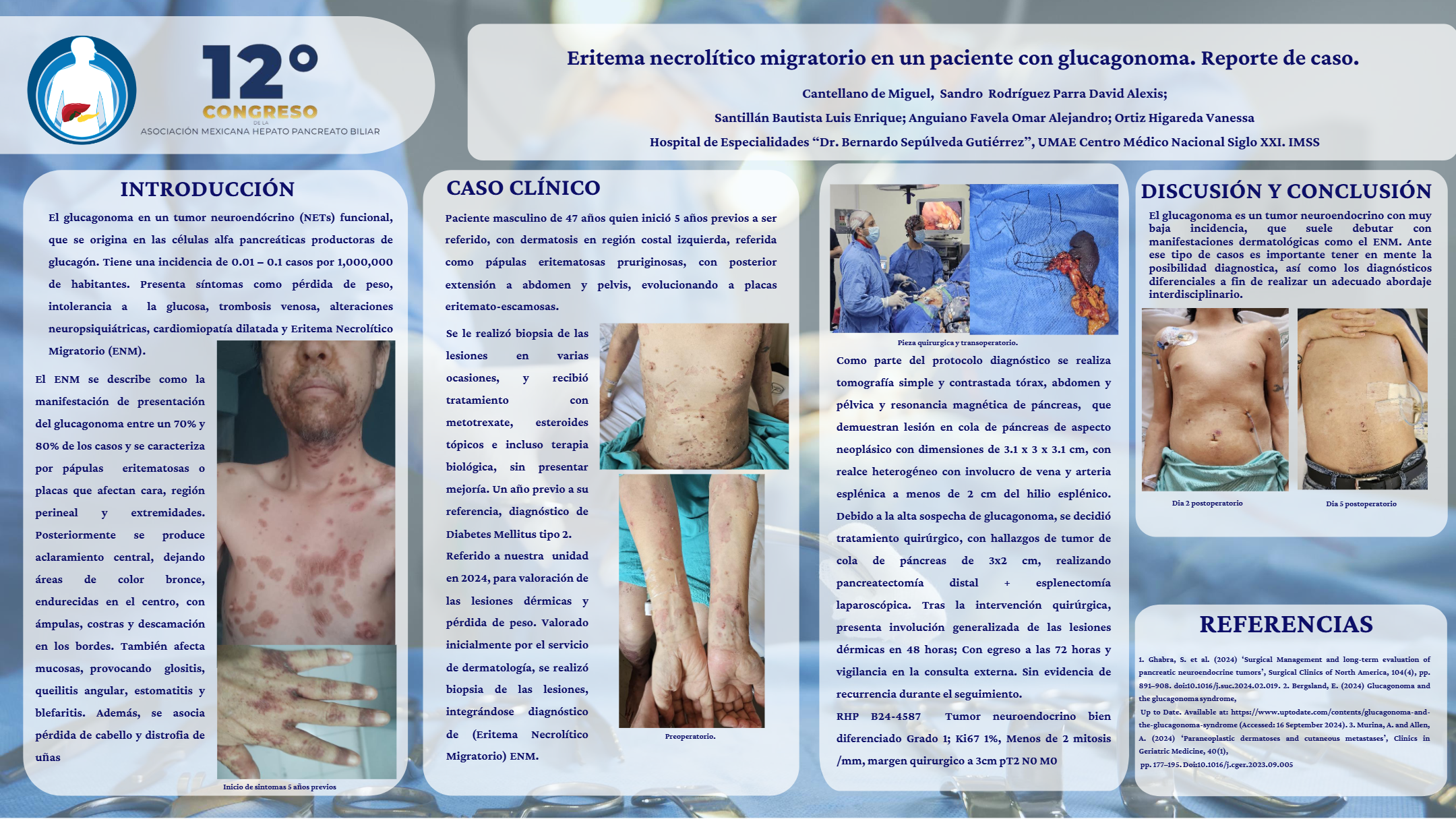 Póster de Eritema necrolítico migratorio en un paciente con glucagonoma. Reporte de caso.