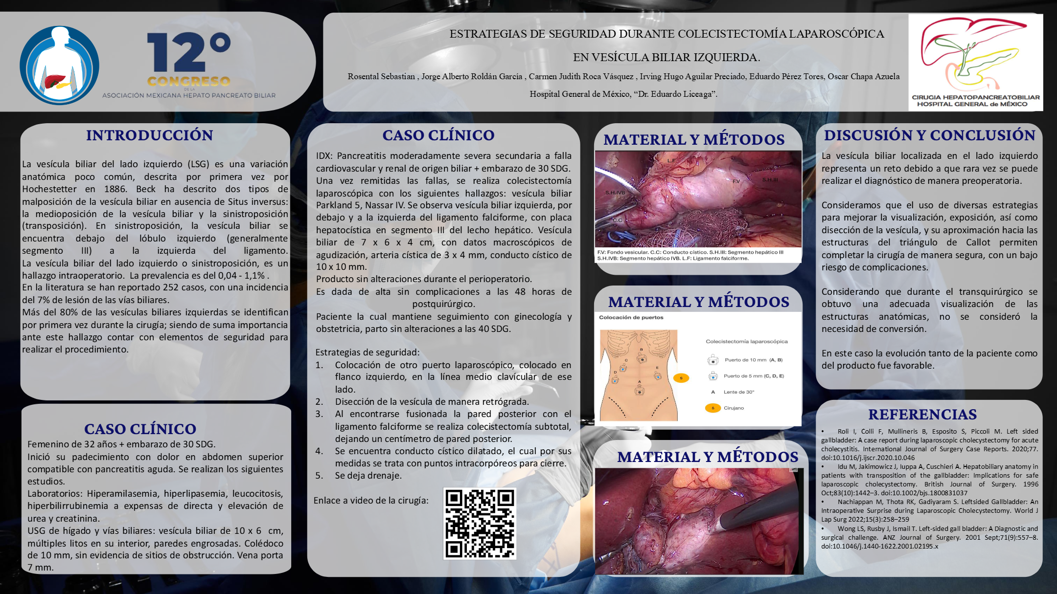 Póster de Estrategias de seguridad durante colecistectomía laparoscópica en vesícula biliar izquierda.