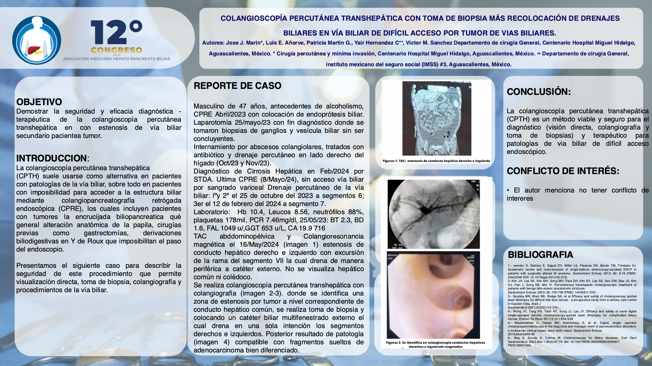 Póster de Colangioscopía percutánea transhepática con toma de biopsia más recolocación de drenajes biliares en vía biliar de difícil acceso por tumor de vía biliar principal.