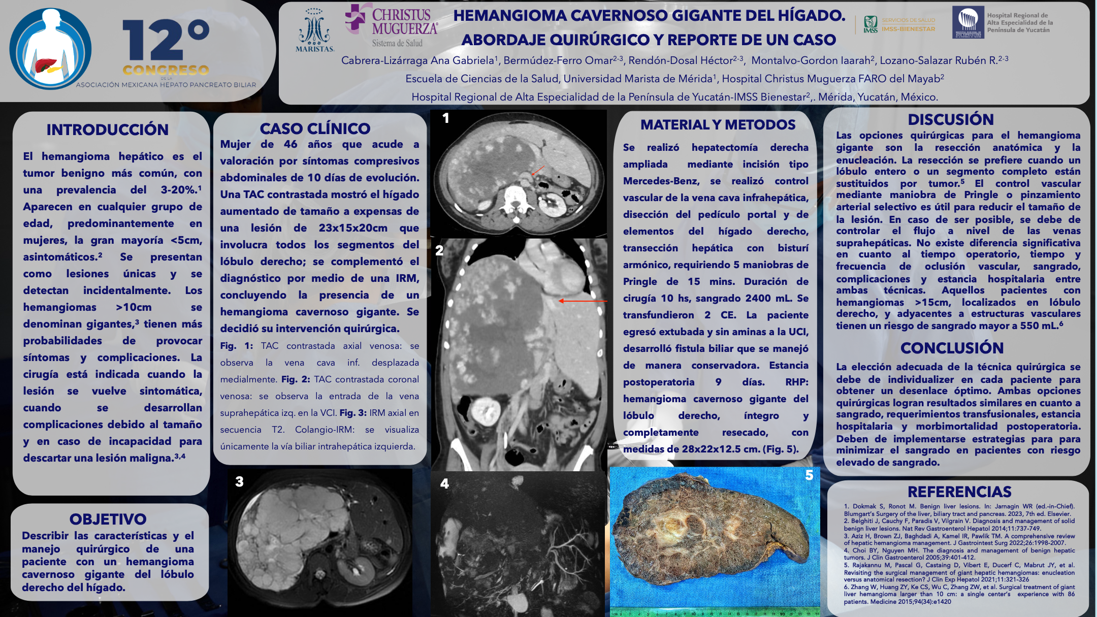 Póster de Hemangioma cavernoso gigante. Abordaje quirúrgico y reporte de un caso.