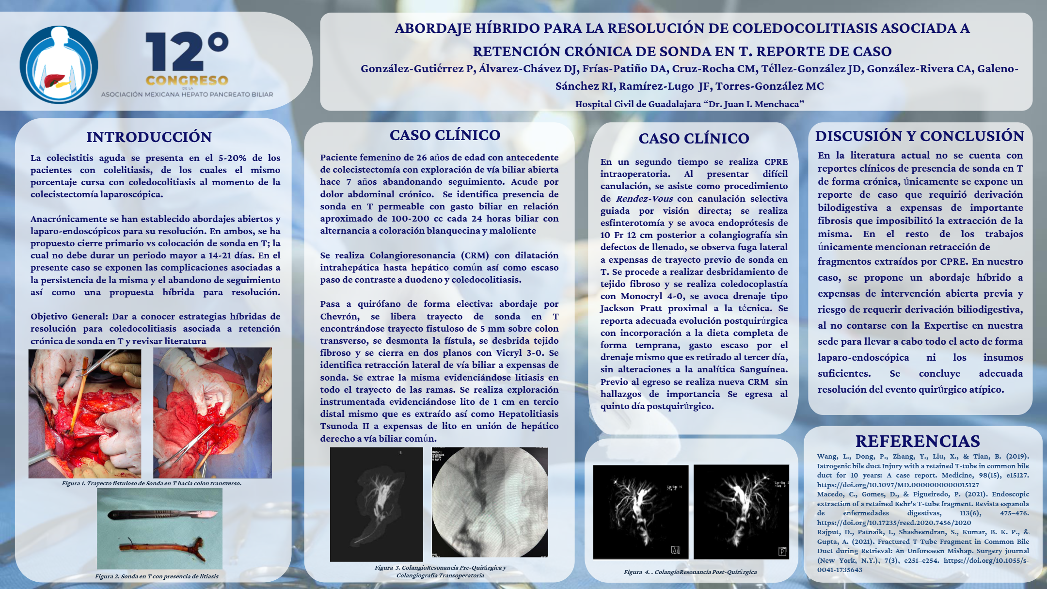 Póster de Abordaje híbrido para la resolución de coledocolitiasis asociada a retención crónica de sonda en T. Reporte de caso.