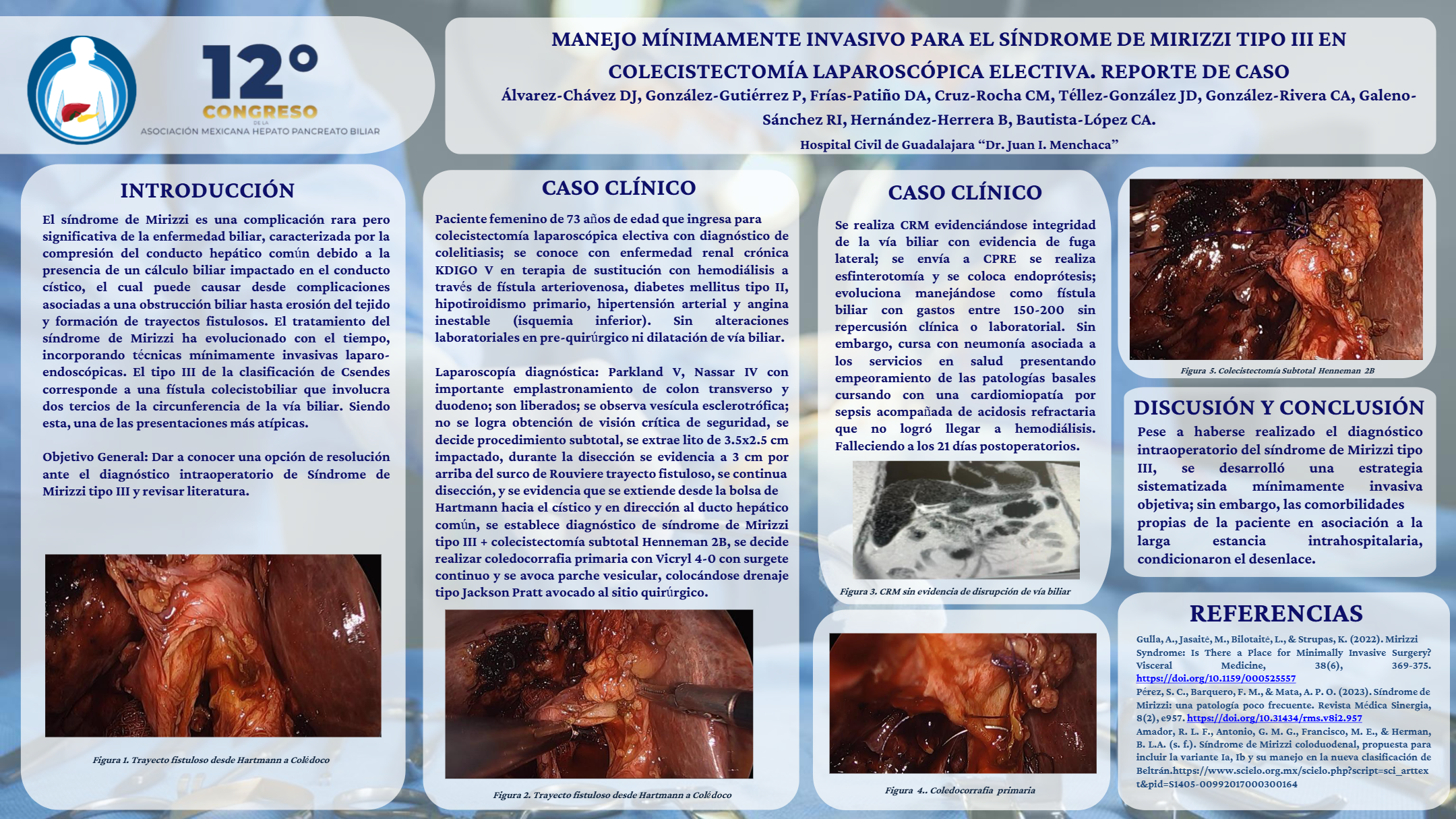 Póster de Manejo mínimamente invasivo para el síndrome de Mirizzi tipo III en colecistectomía laparoscópica electiva. Reporte de caso.